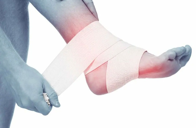 Sơ Cứu Trật Khớp